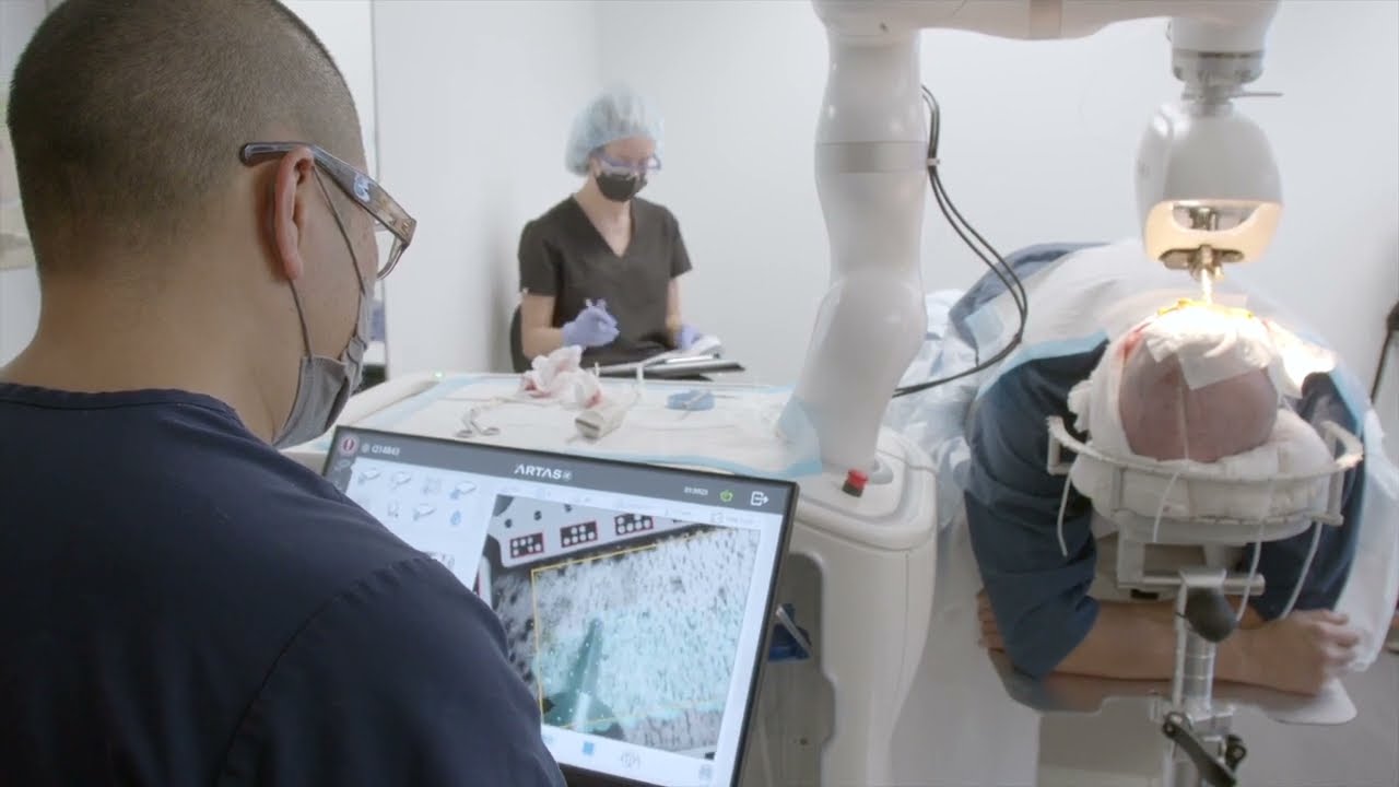 ARTAS iX Robotic hair transplant in Philadelphia