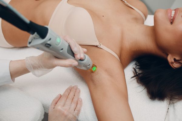 Laser hair removal Philadelphia