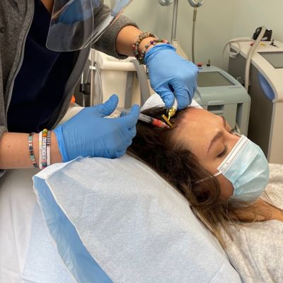 platelet rich plasma hair rejuvenatio