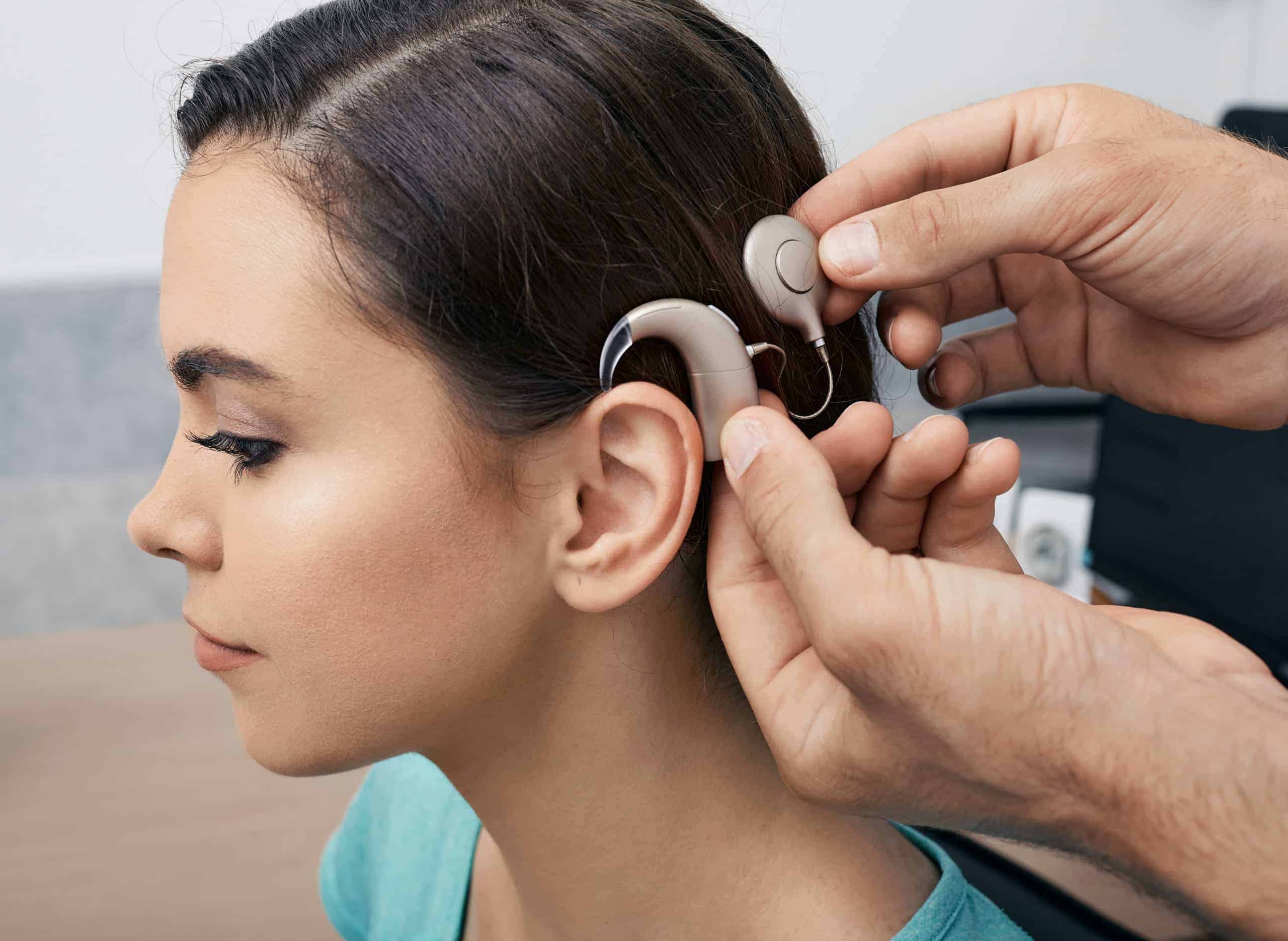 Cochlear Implant Blog AOO scaled 1
